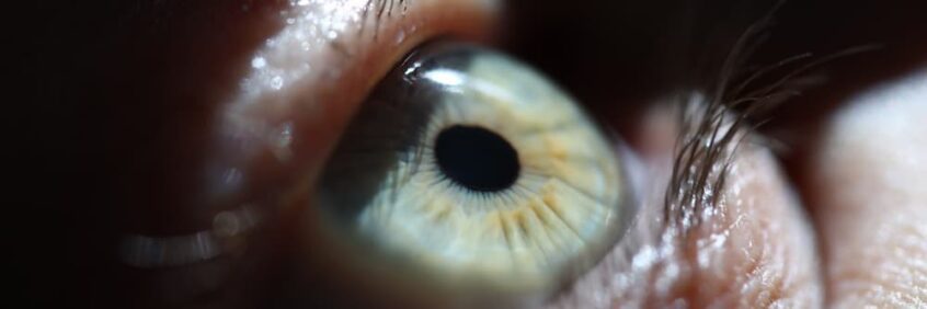 Macro extreme close-up of a human eye with a green and yellow iris, illustrating the effects of sun damage to eyes.